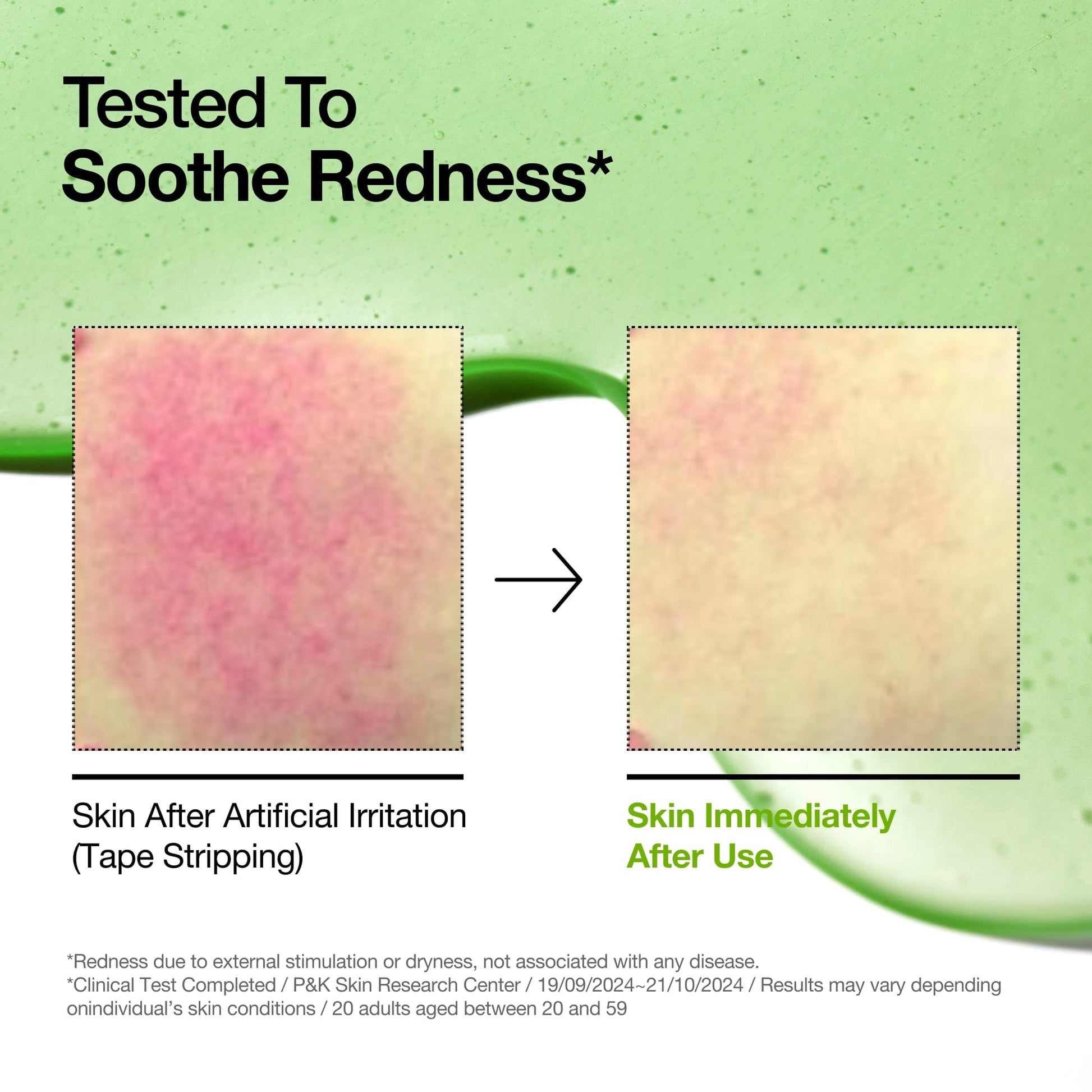 Azelaic Acid 10 Hyaluron Redness Soothing Serum