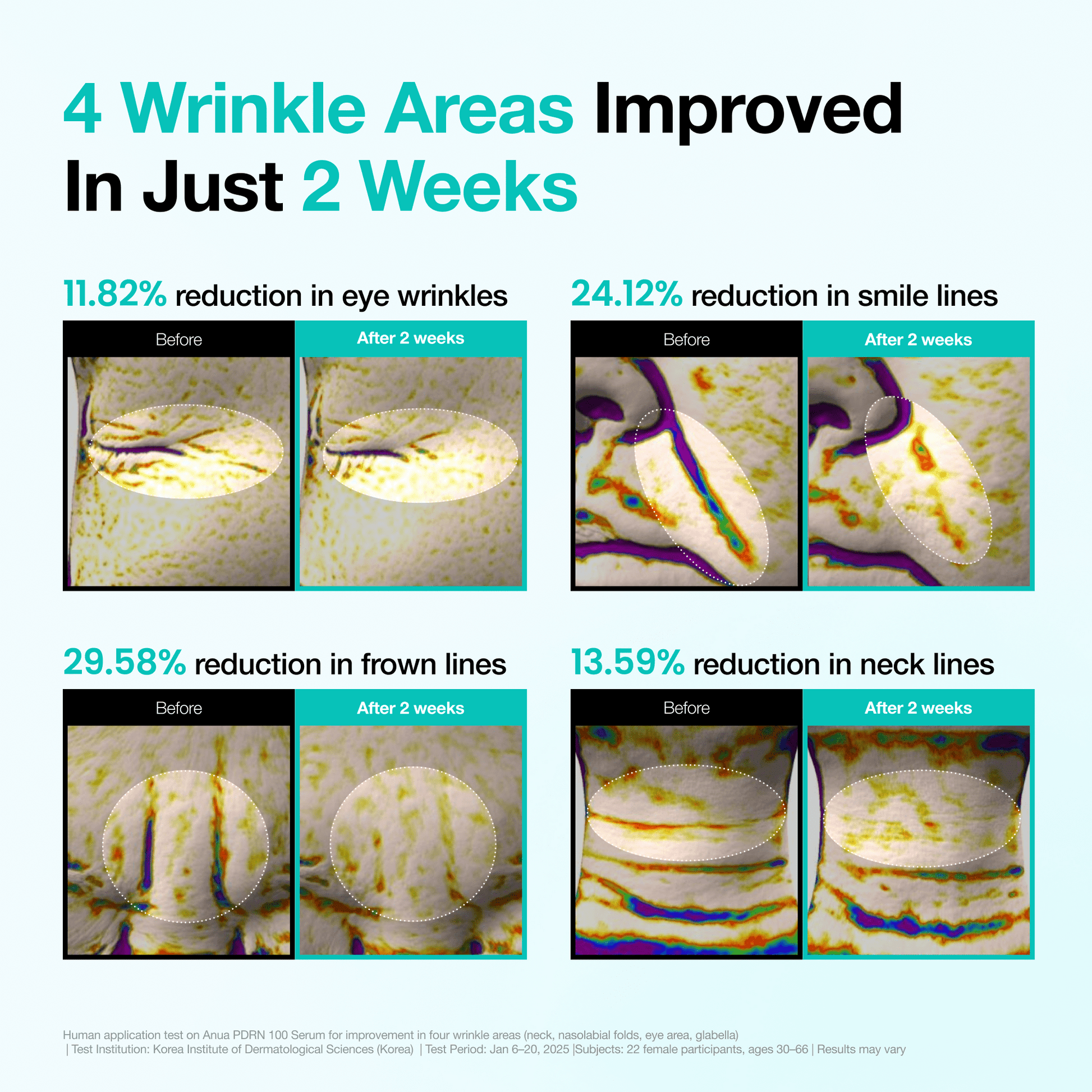 [First 100 Only] Wrinkle-Out Set