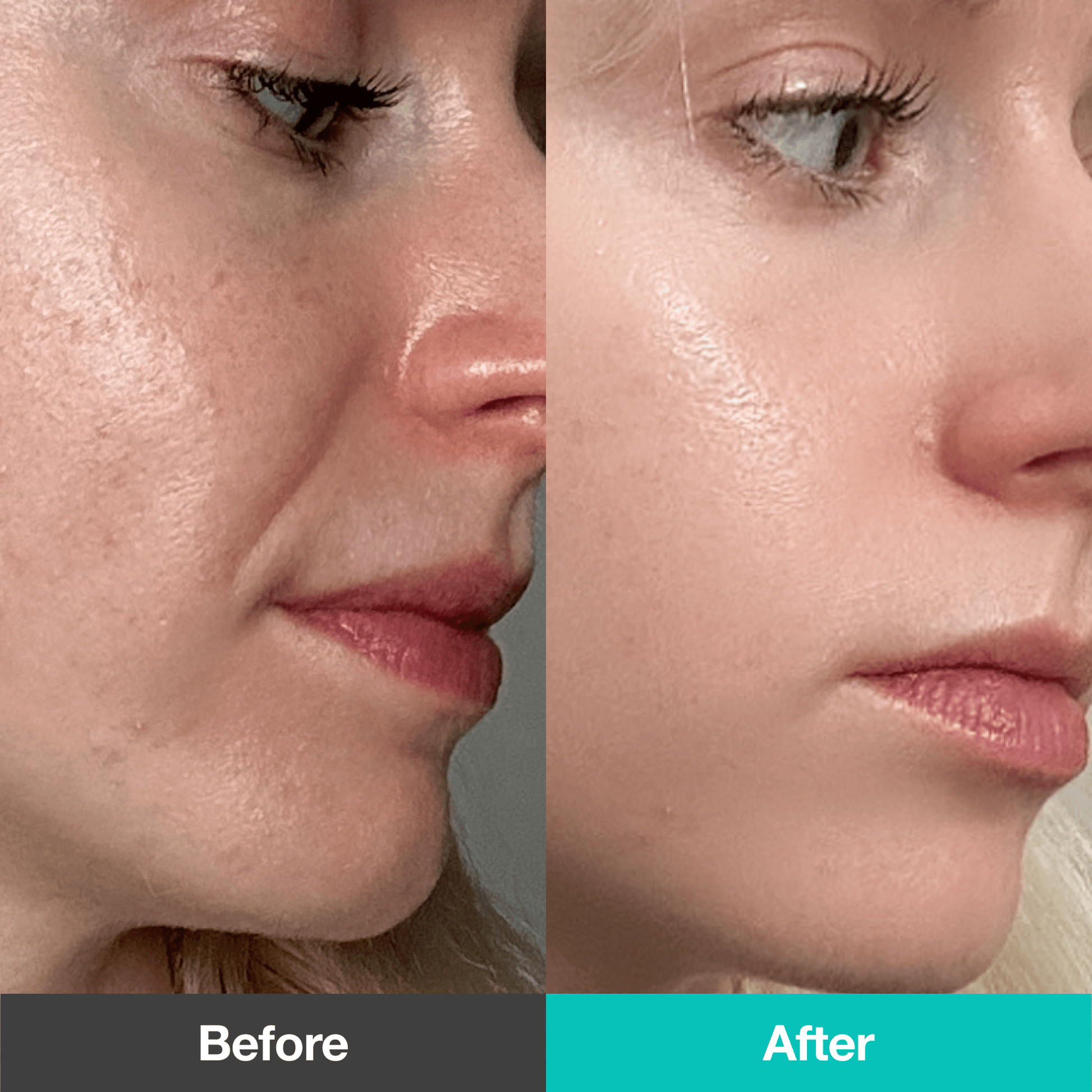 [Secret Deal] 2-Week Wrinkle-Out Routine Set