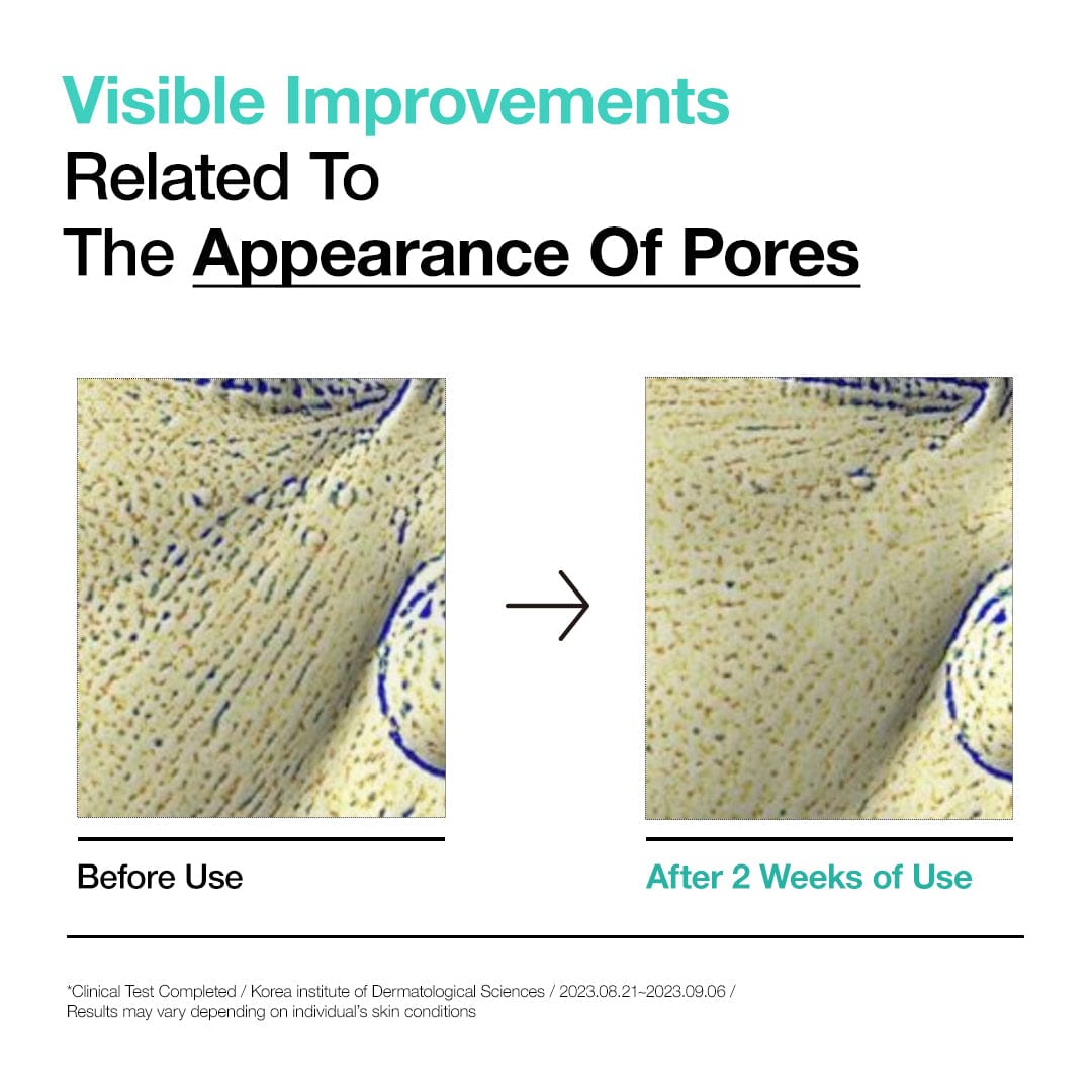 BHA 2% Gentle Exfoliating Toner