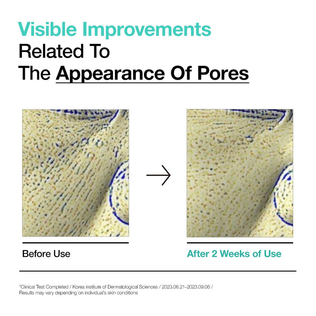 BHA 2% Gentle Exfoliating Toner