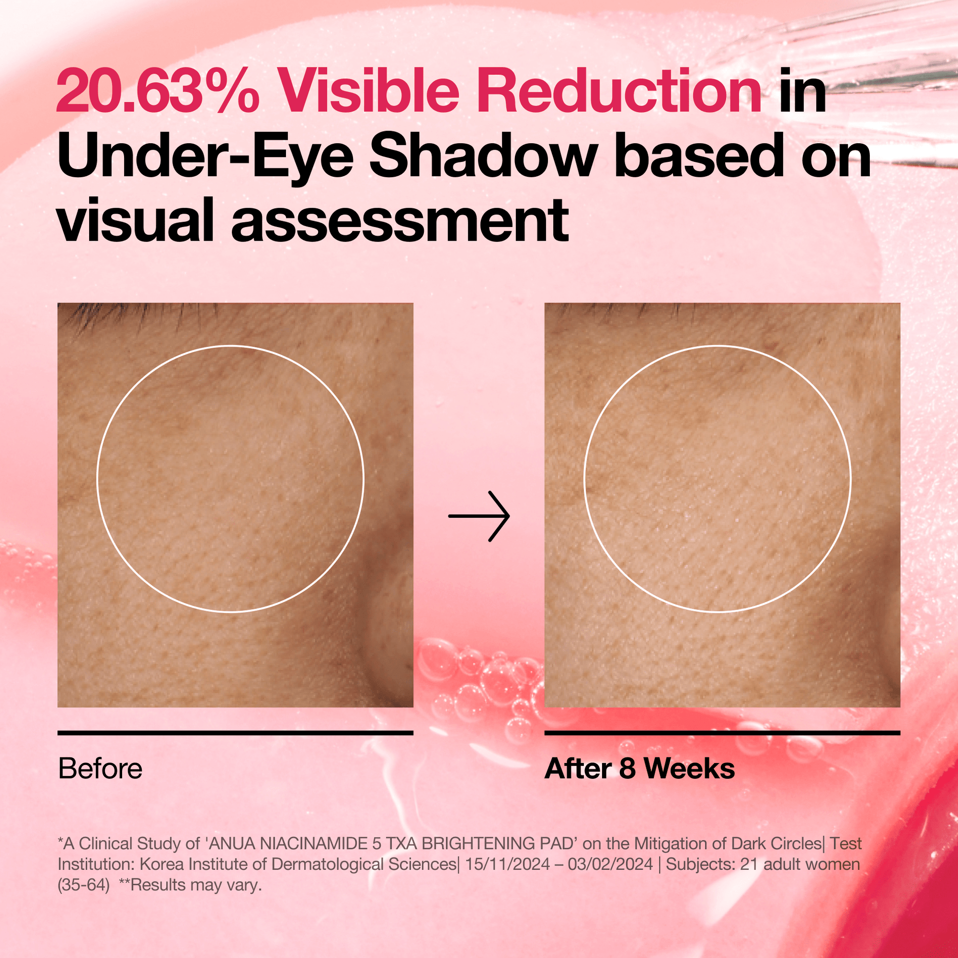 Niacinamide 5 TXA Brightening Pad