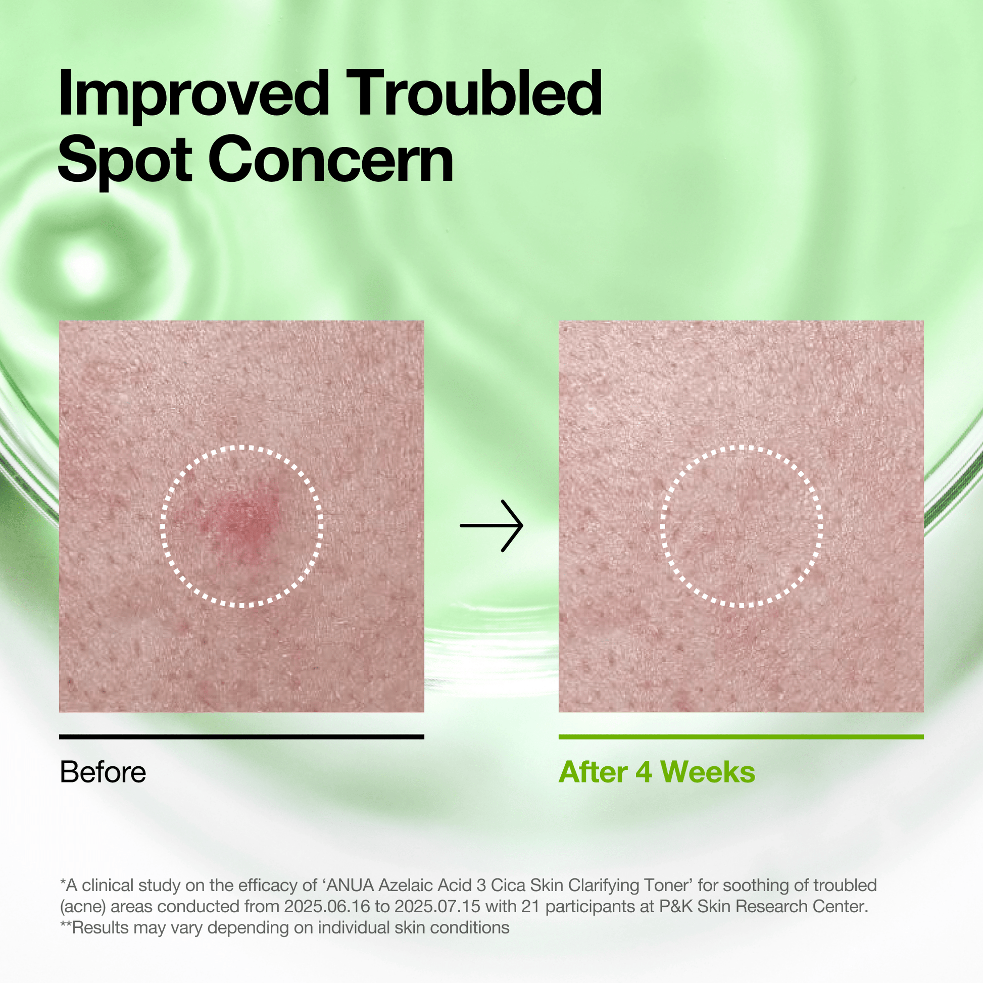 Azelaic 3 Cica Skin Clarifying Toner