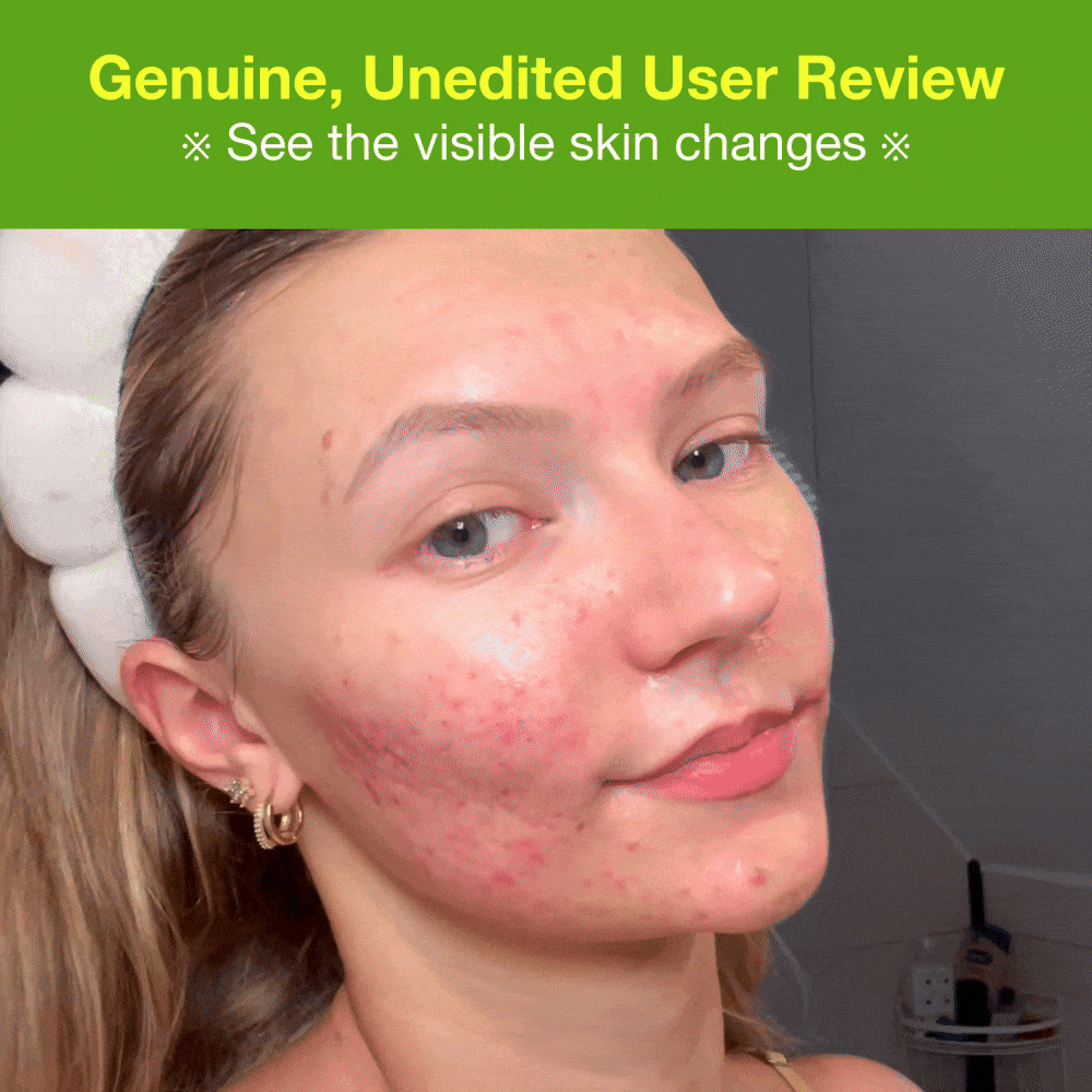 [44%] Breakout Care Routine Set