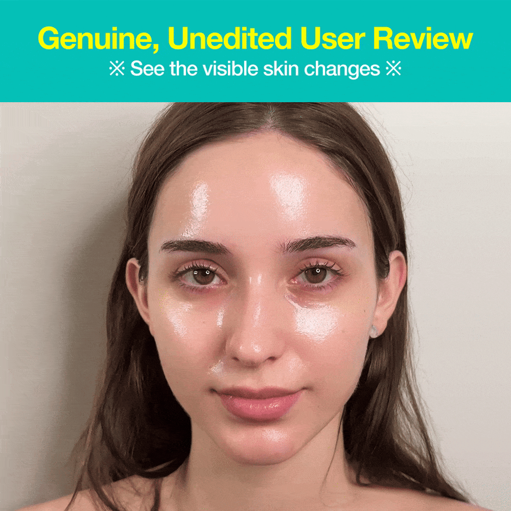 Acne&Dark Spot Repair Set